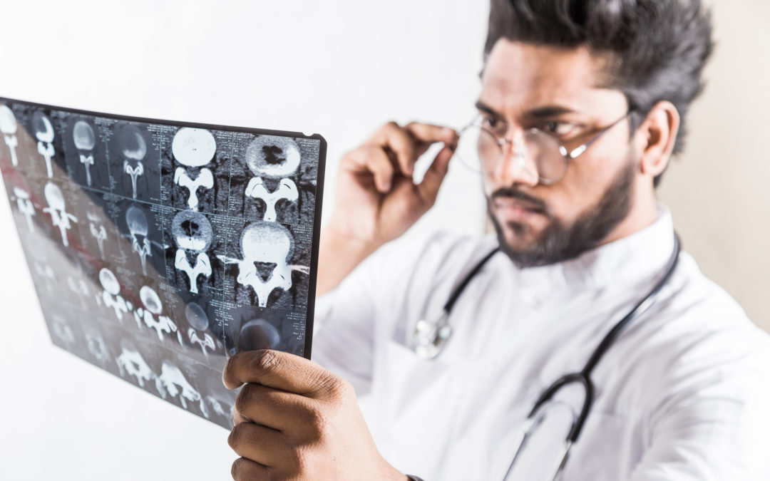 What Can You Do to Prevent Dementia?